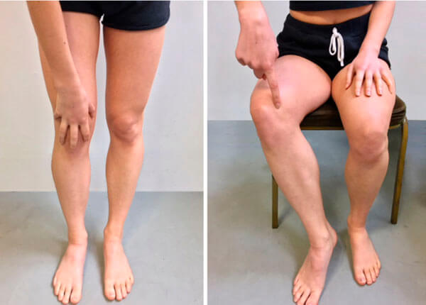 Before and after results