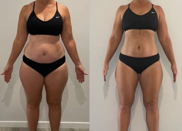 Before and after results