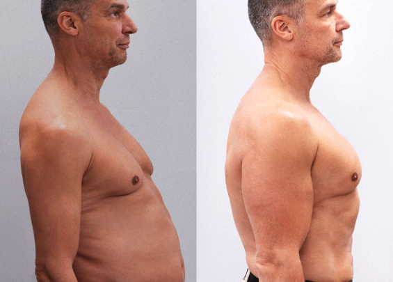 Before and after results