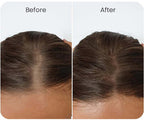Vitalyra Hair Complex