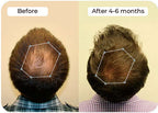 Vitalyra Hair Complex