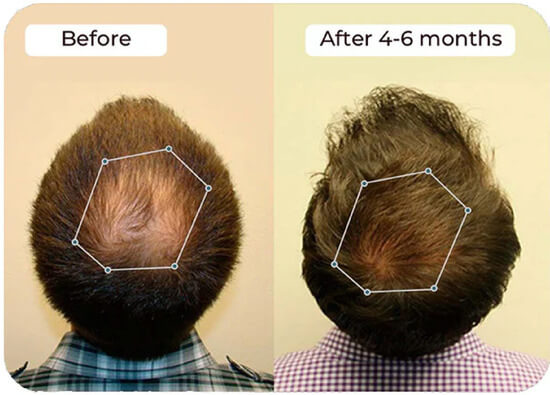 Vital Hair Complex