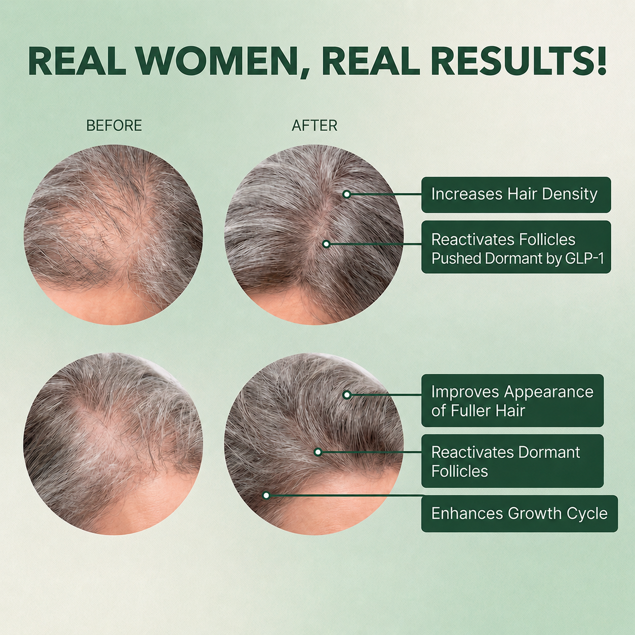 Vital Hair Complex