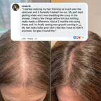 Vitalyra Hair Complex