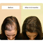 Vitalyra Hair Complex