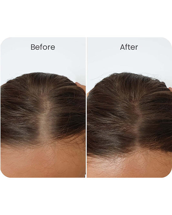 Vital Hair Complex