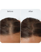 Vitalyra Hair Complex