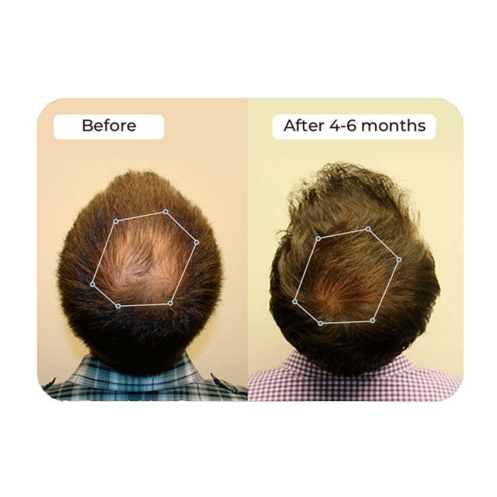 Vital Hair Complex
