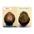 Vitalyra Hair Complex