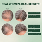 Vitalyra Hair Complex