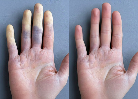 Before and after results